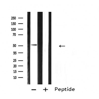 DF4674 staining HepG2 by IF/ICC. The sample were fixed with PFA and permeabilized in 0.1% Triton X-100,then blocked in 10% serum for 45 minutes at 25¡ãC. The primary antibody was diluted at 1/200 and incubated with the sample for 1 hour at 37¡ãC. An  Alexa Fluor 594 conjugated goat anti-rabbit IgG (H+L) Ab, diluted at 1/600, was used as the secondary antibod