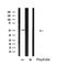 DF4674 staining HepG2 by IF/ICC. The sample were fixed with PFA and permeabilized in 0.1% Triton X-100,then blocked in 10% serum for 45 minutes at 25¡ãC. The primary antibody was diluted at 1/200 and incubated with the sample for 1 hour at 37¡ãC. An  Alexa Fluor 594 conjugated goat anti-rabbit IgG (H+L) Ab, diluted at 1/600, was used as the secondary antibod