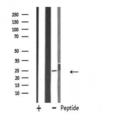 DF4675 staining HepG2 by IF/ICC. The sample were fixed with PFA and permeabilized in 0.1% Triton X-100,then blocked in 10% serum for 45 minutes at 25¡ãC. The primary antibody was diluted at 1/200 and incubated with the sample for 1 hour at 37¡ãC. An  Alexa Fluor 594 conjugated goat anti-rabbit IgG (H+L) Ab, diluted at 1/600, was used as the secondary antibod