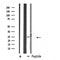 DF4675 staining HepG2 by IF/ICC. The sample were fixed with PFA and permeabilized in 0.1% Triton X-100,then blocked in 10% serum for 45 minutes at 25¡ãC. The primary antibody was diluted at 1/200 and incubated with the sample for 1 hour at 37¡ãC. An  Alexa Fluor 594 conjugated goat anti-rabbit IgG (H+L) Ab, diluted at 1/600, was used as the secondary antibod