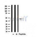 DF4677 staining Hela by IF/ICC. The sample were fixed with PFA and permeabilized in 0.1% Triton X-100,then blocked in 10% serum for 45 minutes at 25¡ãC. The primary antibody was diluted at 1/200 and incubated with the sample for 1 hour at 37¡ãC. An  Alexa Fluor 594 conjugated goat anti-rabbit IgG (H+L) Ab, diluted at 1/600, was used as the secondary antibod