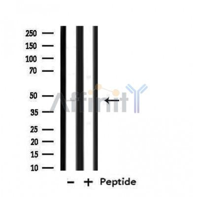 DF4677 staining Hela by IF/ICC. The sample were fixed with PFA and permeabilized in 0.1% Triton X-100,then blocked in 10% serum for 45 minutes at 25¡ãC. The primary antibody was diluted at 1/200 and incubated with the sample for 1 hour at 37¡ãC. An  Alexa Fluor 594 conjugated goat anti-rabbit IgG (H+L) Ab, diluted at 1/600, was used as the secondary antibod