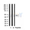 DF4677 staining Hela by IF/ICC. The sample were fixed with PFA and permeabilized in 0.1% Triton X-100,then blocked in 10% serum for 45 minutes at 25¡ãC. The primary antibody was diluted at 1/200 and incubated with the sample for 1 hour at 37¡ãC. An  Alexa Fluor 594 conjugated goat anti-rabbit IgG (H+L) Ab, diluted at 1/600, was used as the secondary antibod