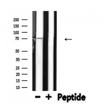 DF4678 staining HepG2 by IF/ICC. The sample were fixed with PFA and permeabilized in 0.1% Triton X-100,then blocked in 10% serum for 45 minutes at 25¡ãC. The primary antibody was diluted at 1/200 and incubated with the sample for 1 hour at 37¡ãC. An  Alexa Fluor 594 conjugated goat anti-rabbit IgG (H+L) Ab, diluted at 1/600, was used as the secondary antibod