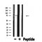 DF4678 staining HepG2 by IF/ICC. The sample were fixed with PFA and permeabilized in 0.1% Triton X-100,then blocked in 10% serum for 45 minutes at 25¡ãC. The primary antibody was diluted at 1/200 and incubated with the sample for 1 hour at 37¡ãC. An  Alexa Fluor 594 conjugated goat anti-rabbit IgG (H+L) Ab, diluted at 1/600, was used as the secondary antibod
