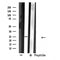 DF4681 staining  293 cells by IF/ICC. The sample were fixed with PFA and permeabilized in 0.1% Triton X-100,then blocked in 10% serum for 45 minutes at 25¡ãC. The primary antibody was diluted at 1/200 and incubated with the sample for 1 hour at 37¡ãC. An  Alexa Fluor 594 conjugated goat anti-rabbit IgG (H+L) antibody(Cat.# S0006), diluted at 1/600, was used as secondary antibod
