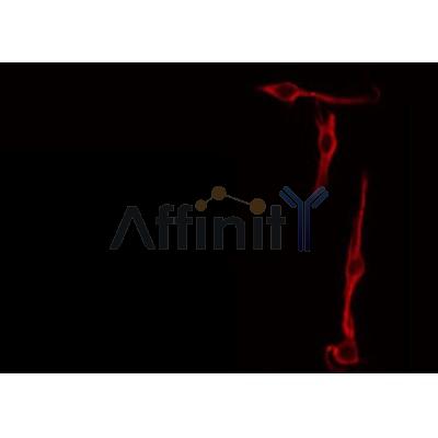 Western blot analysis of extracts from 293 and mouse brain, using SPON2 Antibody.