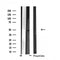 DF4685 staining HuvEc by IF/ICC. The sample were fixed with PFA and permeabilized in 0.1% Triton X-100,then blocked in 10% serum for 45 minutes at 25¡ãC. The primary antibody was diluted at 1/200 and incubated with the sample for 1 hour at 37¡ãC. An  Alexa Fluor 594 conjugated goat anti-rabbit IgG (H+L) Ab, diluted at 1/600, was used as the secondary antibod