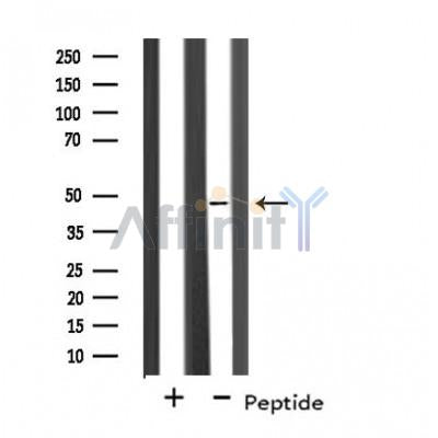 Western blot analysis of extracts from various samples, using BRE Antibody.
 Lane 1: Hela treated with blocking peptide;
 Lane 2: Hela;
Lane 3: 293;
Lane 4: HepG2.