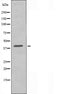 DF4687 staining HeLa by IF/ICC. The sample were fixed with PFA and permeabilized in 0.1% Triton X-100,then blocked in 10% serum for 45 minutes at 25¡ãC. The primary antibody was diluted at 1/200 and incubated with the sample for 1 hour at 37¡ãC. An  Alexa Fluor 594 conjugated goat anti-rabbit IgG (H+L) Ab, diluted at 1/600, was used as the secondary antibod