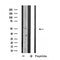DF4689 staining 293 by IF/ICC. The sample were fixed with PFA and permeabilized in 0.1% Triton X-100,then blocked in 10% serum for 45 minutes at 25¡ãC. The primary antibody was diluted at 1/200 and incubated with the sample for 1 hour at 37¡ãC. An  Alexa Fluor 594 conjugated goat anti-rabbit IgG (H+L) Ab, diluted at 1/600, was used as the secondary antibod