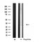 DF4691 staining COLO205 cells by IF/ICC. The sample were fixed with PFA and permeabilized in 0.1% Triton X-100,then blocked in 10% serum for 45 minutes at 25¡ãC. The primary antibody was diluted at 1/200 and incubated with the sample for 1 hour at 37¡ãC. An  Alexa Fluor 594 conjugated goat anti-rabbit IgG (H+L) antibody(Cat.# S0006), diluted at 1/600, was used as secondary antibod