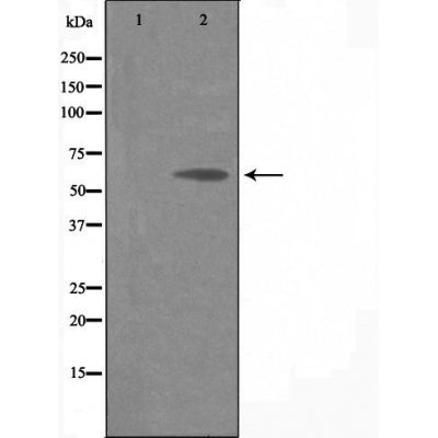 DF4692 staining  HuvEC cells by IF/ICC. The sample were fixed with PFA and permeabilized in 0.1% Triton X-100,then blocked in 10% serum for 45 minutes at 25¡ãC. The primary antibody was diluted at 1/200 and incubated with the sample for 1 hour at 37¡ãC. An  Alexa Fluor 594 conjugated goat anti-rabbit IgG (H+L) antibody(Cat.# S0006), diluted at 1/600, was used as secondary antibod