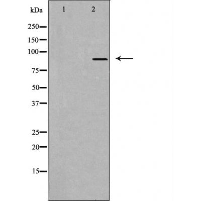 DF4693 staining HuvEC cells by IF/ICC. The sample were fixed with PFA and permeabilized in 0.1% Triton X-100,then blocked in 10% serum for 45 minutes at 25¡ãC. The primary antibody was diluted at 1/200 and incubated with the sample for 1 hour at 37¡ãC. An  Alexa Fluor 594 conjugated goat anti-rabbit IgG (H+L) antibody(Cat.# S0006), diluted at 1/600, was used as secondary antibod