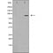 DF4693 staining HuvEC cells by IF/ICC. The sample were fixed with PFA and permeabilized in 0.1% Triton X-100,then blocked in 10% serum for 45 minutes at 25¡ãC. The primary antibody was diluted at 1/200 and incubated with the sample for 1 hour at 37¡ãC. An  Alexa Fluor 594 conjugated goat anti-rabbit IgG (H+L) antibody(Cat.# S0006), diluted at 1/600, was used as secondary antibod