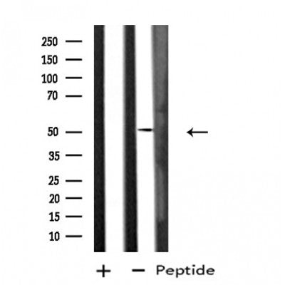 DF4694 staining  NIH-3T3 cells by IF/ICC. The sample were fixed with PFA and permeabilized in 0.1% Triton X-100,then blocked in 10% serum for 45 minutes at 25¡ãC. The primary antibody was diluted at 1/200 and incubated with the sample for 1 hour at 37¡ãC. An  Alexa Fluor 594 conjugated goat anti-rabbit IgG (H+L) antibody(Cat.# S0006), diluted at 1/600, was used as secondary antibod