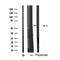 DF4695 staining COLO205 by IF/ICC. The sample were fixed with PFA and permeabilized in 0.1% Triton X-100,then blocked in 10% serum for 45 minutes at 25¡ãC. The primary antibody was diluted at 1/200 and incubated with the sample for 1 hour at 37¡ãC. An  Alexa Fluor 594 conjugated goat anti-rabbit IgG (H+L) Ab, diluted at 1/600, was used as the secondary antibod