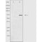DF4704 staining  HuvEC/ cells by IF/ICC. The sample were fixed with PFA and permeabilized in 0.1% Triton X-100,then blocked in 10% serum for 45 minutes at 25¡ãC. The primary antibody was diluted at 1/200 and incubated with the sample for 1 hour at 37¡ãC. An  Alexa Fluor 594 conjugated goat anti-rabbit IgG (H+L) antibody(Cat.# S0006), diluted at 1/600, was used as secondary antibod