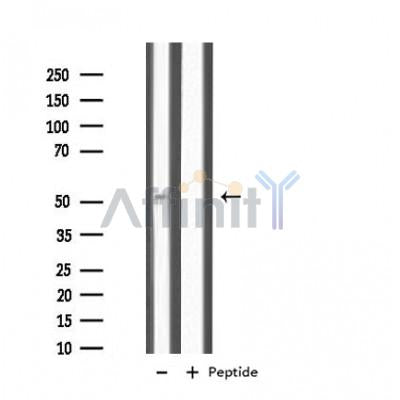 Western blot analysis of extracts from rat brain, using IL11RA Antibody. Lane 1 was treated with the antigen-specific peptide.