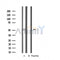 Western blot analysis of extracts from rat brain, using IL11RA Antibody. Lane 1 was treated with the antigen-specific peptide.