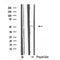 DF4706 staining HepG2 by IF/ICC. The sample were fixed with PFA and permeabilized in 0.1% Triton X-100,then blocked in 10% serum for 45 minutes at 25¡ãC. The primary antibody was diluted at 1/200 and incubated with the sample for 1 hour at 37¡ãC. An  Alexa Fluor 594 conjugated goat anti-rabbit IgG (H+L) Ab, diluted at 1/600, was used as the secondary antibod