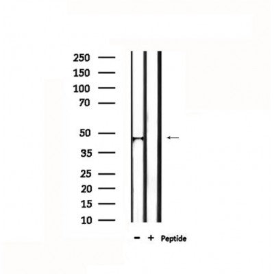 DF4709 staining HepG2 by IF/ICC. The sample were fixed with PFA and permeabilized in 0.1% Triton X-100,then blocked in 10% serum for 45 minutes at 25¡ãC. The primary antibody was diluted at 1/200 and incubated with the sample for 1 hour at 37¡ãC. An  Alexa Fluor 594 conjugated goat anti-rabbit IgG (H+L) Ab, diluted at 1/600, was used as the secondary antibod