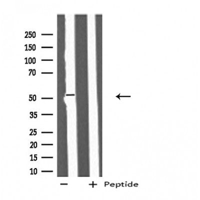 DF4711 staining Hela cells by IF/ICC. The sample were fixed with PFA and permeabilized in 0.1% Triton X-100,then blocked in 10% serum for 45 minutes at 25¡ãC. The primary antibody was diluted at 1/200 and incubated with the sample for 1 hour at 37¡ãC. An  Alexa Fluor 594 conjugated goat anti-rabbit IgG (H+L) antibody(Cat.# S0006), diluted at 1/600, was used as secondary antibod