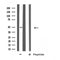 DF4714 staining LOVO cells by IF/ICC. The sample were fixed with PFA and permeabilized in 0.1% Triton X-100,then blocked in 10% serum for 45 minutes at 25¡ãC. The primary antibody was diluted at 1/200 and incubated with the sample for 1 hour at 37¡ãC. An  Alexa Fluor 594 conjugated goat anti-rabbit IgG (H+L) antibody(Cat.# S0006), diluted at 1/600, was used as secondary antibod