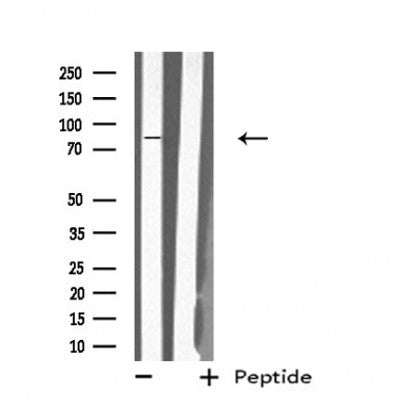 Western blot analysis of extracts from 293, using MX2 Antibody. Lane 1 was treated with the antigen-specific peptide.