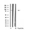 Western blot analysis of extracts from 293, using MX2 Antibody. Lane 1 was treated with the antigen-specific peptide.
