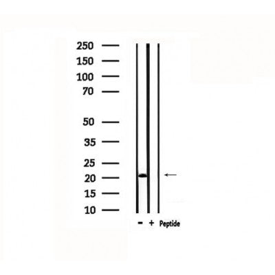 DF4717 staining HuvEC cells by IF/ICC. The sample were fixed with PFA and permeabilized in 0.1% Triton X-100,then blocked in 10% serum for 45 minutes at 25¡ãC. The primary antibody was diluted at 1/200 and incubated with the sample for 1 hour at 37¡ãC. An  Alexa Fluor 594 conjugated goat anti-rabbit IgG (H+L) antibody(Cat.# S0006), diluted at 1/600, was used as secondary antibod