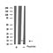 DF4718 staining Hela cells by IF/ICC. The sample were fixed with PFA and permeabilized in 0.1% Triton X-100,then blocked in 10% serum for 45 minutes at 25¡ãC. The primary antibody was diluted at 1/200 and incubated with the sample for 1 hour at 37¡ãC. An  Alexa Fluor 594 conjugated goat anti-rabbit IgG (H+L) antibody(Cat.# S0006), diluted at 1/600, was used as secondary antibod