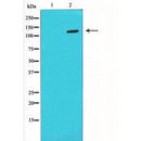 DF4721 staining Hela cells by IF/ICC. The sample were fixed with PFA and permeabilized in 0.1% Triton X-100,then blocked in 10% serum for 45 minutes at 25¡ãC. The primary antibody was diluted at 1/200 and incubated with the sample for 1 hour at 37¡ãC. An  Alexa Fluor 594 conjugated goat anti-rabbit IgG (H+L) antibody(Cat.