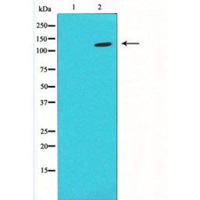 DF4721 staining Hela cells by IF/ICC. The sample were fixed with PFA and permeabilized in 0.1% Triton X-100,then blocked in 10% serum for 45 minutes at 25¡ãC. The primary antibody was diluted at 1/200 and incubated with the sample for 1 hour at 37¡ãC. An  Alexa Fluor 594 conjugated goat anti-rabbit IgG (H+L) antibody(Cat.# S0006), diluted at 1/600, was used as secondary antibod