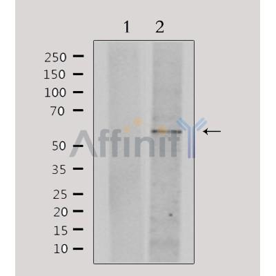 DF4722 staining Hela by IF/ICC. The sample were fixed with PFA and permeabilized in 0.1% Triton X-100,then blocked in 10% serum for 45 minutes at 25¡ãC. The primary antibody was diluted at 1/200 and incubated with the sample for 1 hour at 37¡ãC. An  Alexa Fluor 594 conjugated goat anti-rabbit IgG (H+L) Ab, diluted at 1/600, was used as the secondary antibod