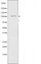 DF4723 staining HepG2 cells by IF/ICC. The sample were fixed with PFA and permeabilized in 0.1% Triton X-100,then blocked in 10% serum for 45 minutes at 25¡ãC. The primary antibody was diluted at 1/200 and incubated with the sample for 1 hour at 37¡ãC. An  Alexa Fluor 594 conjugated goat anti-rabbit IgG (H+L) antibody(Cat.# S0006), diluted at 1/600, was used as secondary antibod