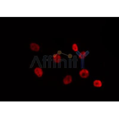 Western blot analysis of extracts from HepG2, using SUV39H2 Antibody. Lane 1 was treated with the antigen-specific peptide.