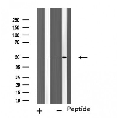 DF4727 staining  HuvEc cells by IF/ICC. The sample were fixed with PFA and permeabilized in 0.1% Triton X-100,then blocked in 10% serum for 45 minutes at 25¡ãC. The primary antibody was diluted at 1/200 and incubated with the sample for 1 hour at 37¡ãC. An  Alexa Fluor 594 conjugated goat anti-rabbit IgG (H+L) antibody(Cat.# S0006), diluted at 1/600, was used as secondary antibod