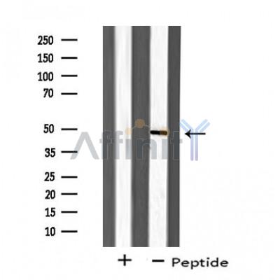 DF4729 staining 293 by IF/ICC. The sample were fixed with PFA and permeabilized in 0.1% Triton X-100,then blocked in 10% serum for 45 minutes at 25¡ãC. The primary antibody was diluted at 1/200 and incubated with the sample for 1 hour at 37¡ãC. An  Alexa Fluor 594 conjugated goat anti-rabbit IgG (H+L) Ab, diluted at 1/600, was used as the secondary antibod
