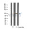 DF4729 staining 293 by IF/ICC. The sample were fixed with PFA and permeabilized in 0.1% Triton X-100,then blocked in 10% serum for 45 minutes at 25¡ãC. The primary antibody was diluted at 1/200 and incubated with the sample for 1 hour at 37¡ãC. An  Alexa Fluor 594 conjugated goat anti-rabbit IgG (H+L) Ab, diluted at 1/600, was used as the secondary antibod
