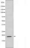DF4730 staining Hela cells by IF/ICC. The sample were fixed with PFA and permeabilized in 0.1% Triton X-100,then blocked in 10% serum for 45 minutes at 25¡ãC. The primary antibody was diluted at 1/200 and incubated with the sample for 1 hour at 37¡ãC. An  Alexa Fluor 594 conjugated goat anti-rabbit IgG (H+L) antibody(Cat.