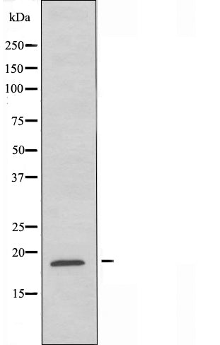 DF4730 staining Hela cells by IF/ICC. The sample were fixed with PFA and permeabilized in 0.1% Triton X-100,then blocked in 10% serum for 45 minutes at 25¡ãC. The primary antibody was diluted at 1/200 and incubated with the sample for 1 hour at 37¡ãC. An  Alexa Fluor 594 conjugated goat anti-rabbit IgG (H+L) antibody(Cat.