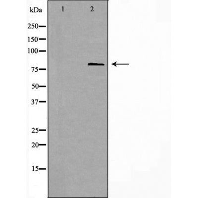 DF4731 staining  HeLa cells by IF/ICC. The sample were fixed with PFA and permeabilized in 0.1% Triton X-100,then blocked in 10% serum for 45 minutes at 25¡ãC. The primary antibody was diluted at 1/200 and incubated with the sample for 1 hour at 37¡ãC. An  Alexa Fluor 594 conjugated goat anti-rabbit IgG (H+L) antibody(Cat.# S0006), diluted at 1/600, was used as secondary antibod
