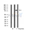 DF4733 staining Hela by IF/ICC. The sample were fixed with PFA and permeabilized in 0.1% Triton X-100,then blocked in 10% serum for 45 minutes at 25¡ãC. The primary antibody was diluted at 1/200 and incubated with the sample for 1 hour at 37¡ãC. An  Alexa Fluor 594 conjugated goat anti-rabbit IgG (H+L) Ab, diluted at 1/600, was used as the secondary antibod