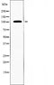 DF4734 staining Hela by IF/ICC. The sample were fixed with PFA and permeabilized in 0.1% Triton X-100,then blocked in 10% serum for 45 minutes at 25¡ãC. The primary antibody was diluted at 1/200 and incubated with the sample for 1 hour at 37¡ãC. An  Alexa Fluor 594 conjugated goat anti-rabbit IgG (H+L) Ab, diluted at 1/600, was used as the secondary antibod