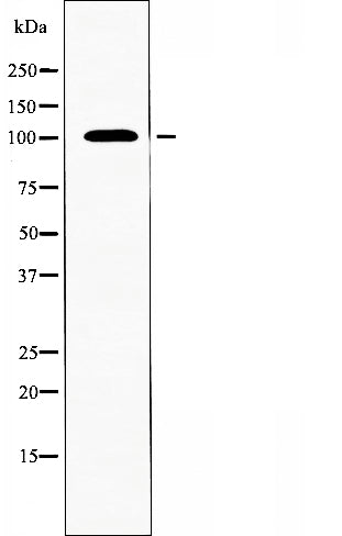 DF4734 staining Hela by IF/ICC. The sample were fixed with PFA and permeabilized in 0.1% Triton X-100,then blocked in 10% serum for 45 minutes at 25¡ãC. The primary antibody was diluted at 1/200 and incubated with the sample for 1 hour at 37¡ãC. An  Alexa Fluor 594 conjugated goat anti-rabbit IgG (H+L) Ab, diluted at 1/600, was used as the secondary antibod