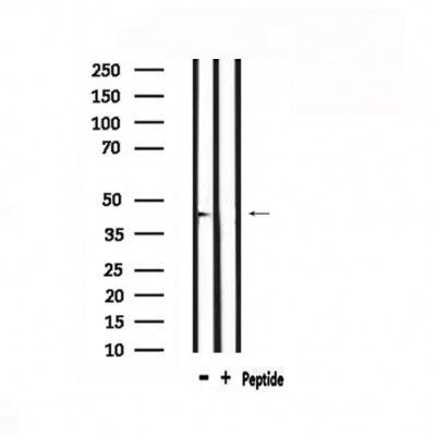 DF4736 staining HepG2 by IF/ICC. The sample were fixed with PFA and permeabilized in 0.1% Triton X-100,then blocked in 10% serum for 45 minutes at 25¡ãC. The primary antibody was diluted at 1/200 and incubated with the sample for 1 hour at 37¡ãC. An  Alexa Fluor 594 conjugated goat anti-rabbit IgG (H+L) Ab, diluted at 1/600, was used as the secondary antibod