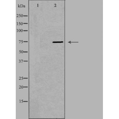 DF4738 staining HepG2 by IF/ICC. The sample were fixed with PFA and permeabilized in 0.1% Triton X-100,then blocked in 10% serum for 45 minutes at 25¡ãC. The primary antibody was diluted at 1/200 and incubated with the sample for 1 hour at 37¡ãC. An  Alexa Fluor 594 conjugated goat anti-rabbit IgG (H+L) Ab, diluted at 1/600, was used as the secondary antibod