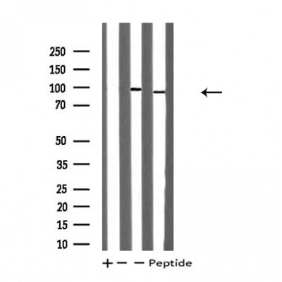 DF4741 staining Hela by IF/ICC. The sample were fixed with PFA and permeabilized in 0.1% Triton X-100,then blocked in 10% serum for 45 minutes at 25¡ãC. The primary antibody was diluted at 1/200 and incubated with the sample for 1 hour at 37¡ãC. An  Alexa Fluor 594 conjugated goat anti-rabbit IgG (H+L) Ab, diluted at 1/600, was used as the secondary antibod