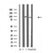DF4741 staining Hela by IF/ICC. The sample were fixed with PFA and permeabilized in 0.1% Triton X-100,then blocked in 10% serum for 45 minutes at 25¡ãC. The primary antibody was diluted at 1/200 and incubated with the sample for 1 hour at 37¡ãC. An  Alexa Fluor 594 conjugated goat anti-rabbit IgG (H+L) Ab, diluted at 1/600, was used as the secondary antibod